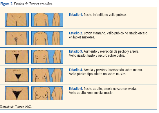 Figura 2. Escalas de Tanner en niñas.